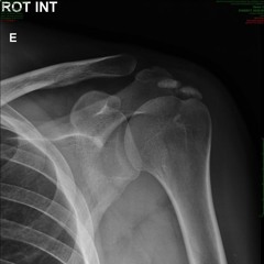 Dos prazeres do toque frio - Rebobine antes de devolver