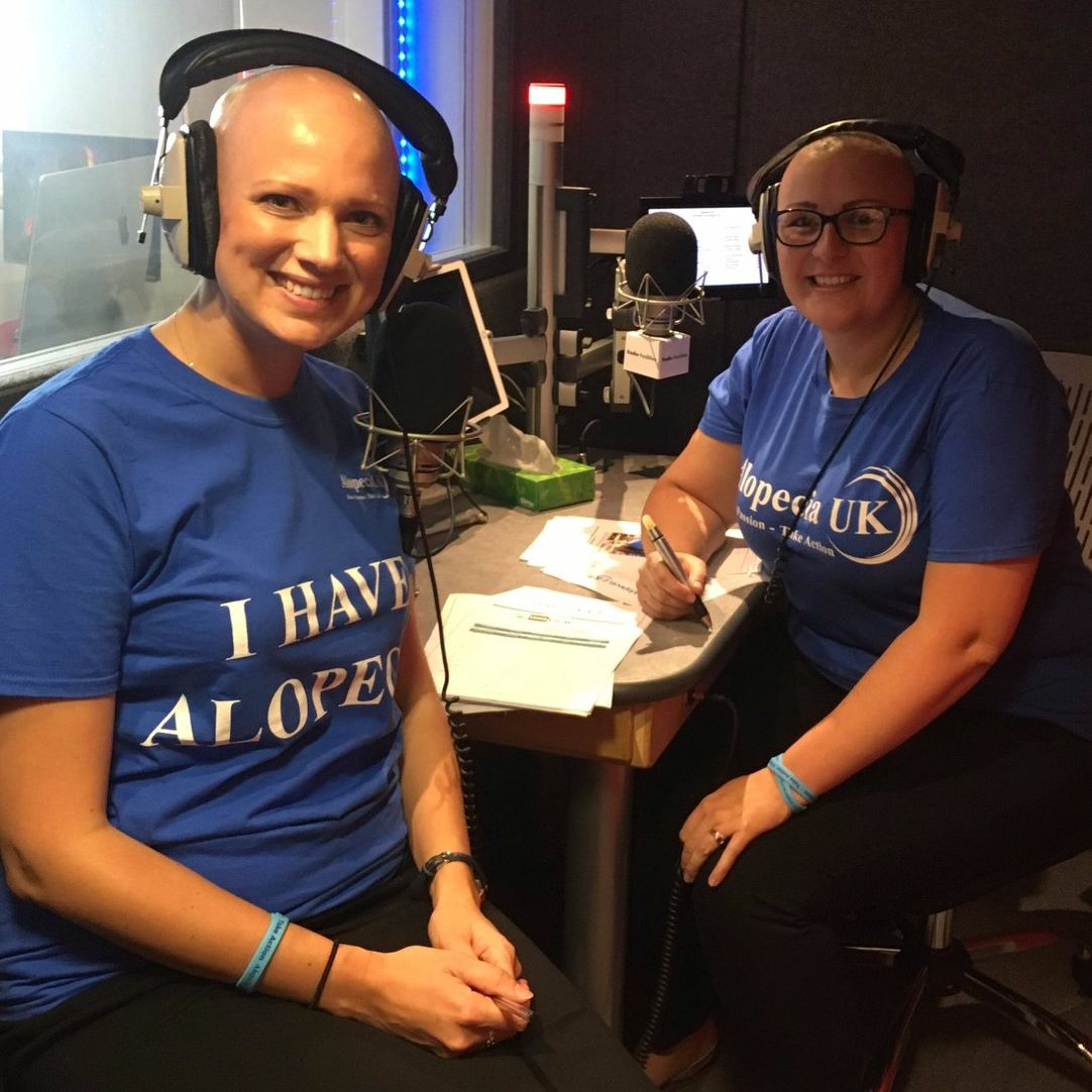 Alopecia UK Interview
