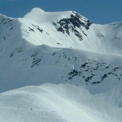 I've Got These Blues (Where Are You)(Draft - Add Treble)