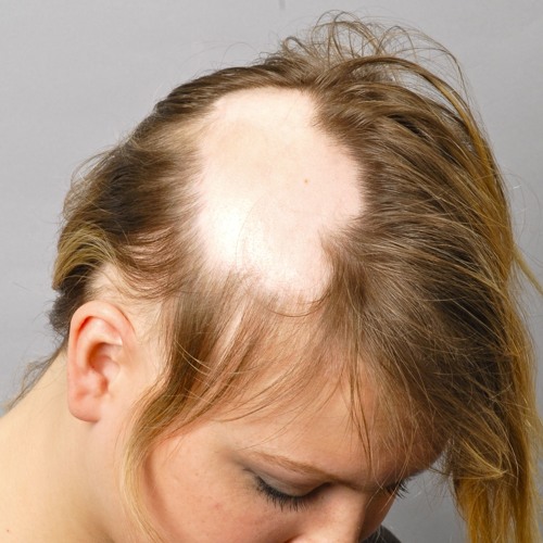 Don T Tear Yr Hair Out Alicia Rough Demo By Bret Tobias Don T Tear Yr Hair Out Alicia Rough Demo By Bret Tobias