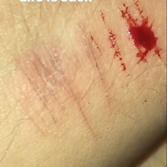 Today (Produced.By 1mill)