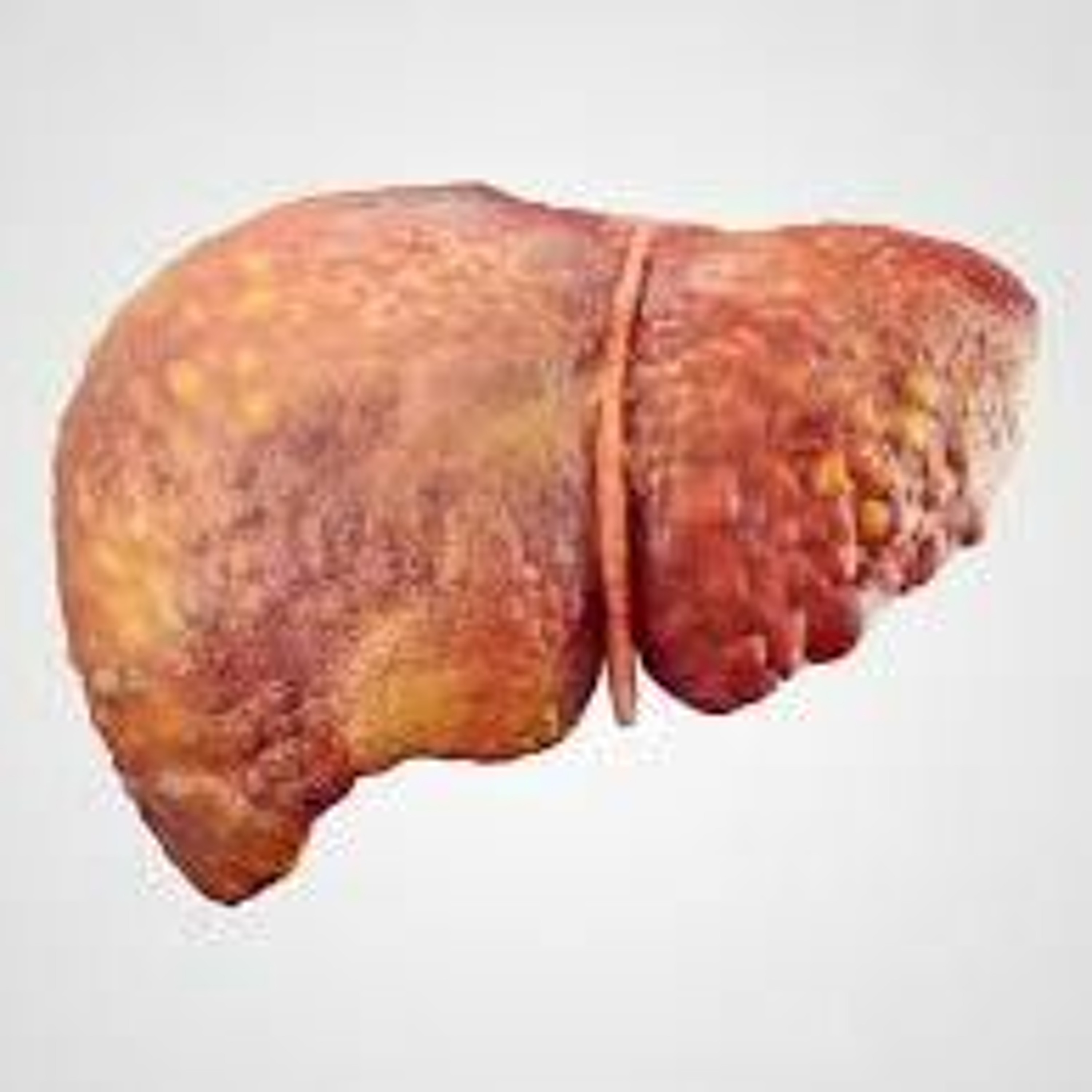 The Fatty Liver: Drugs And Alcohol Podcast episode artwork