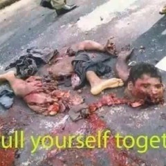 Intestinal Noose - Chunks of Flesh Splattered Everywhere