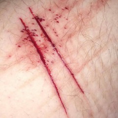 THE BENZO CYCLE CONTINUES (prod. skel)