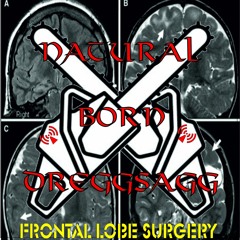 Natural born Dreggsagg - Frontal lobe surgery