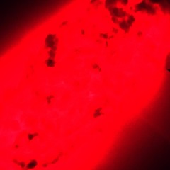 Rabies ($UICIDEBOY$ type beat)