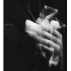 Acción Diplomática .  Arde