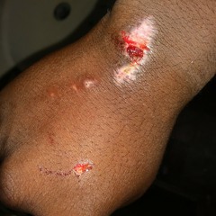 Die (one of my verse to my old songs