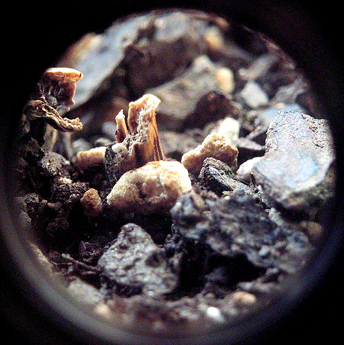 What Is The Difference Between Regular Probiotics And Soil Based Organisms Like Prescript Assist episode artwork