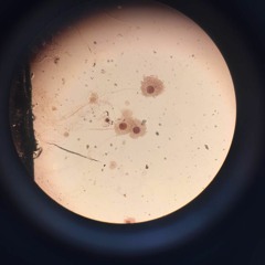 Bites And Rust
