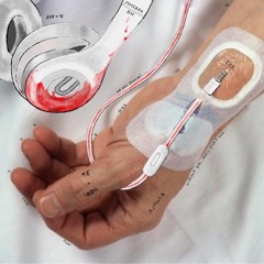 Arterial Line