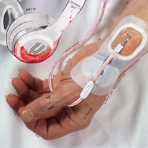 Arterial Line