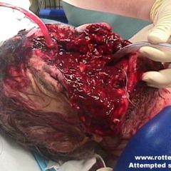 Dr. Ugs (a.k.a. Arcid) - Annoying (2004)