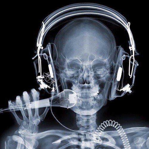 Bones(Lewis Watson)Cover by Derek French