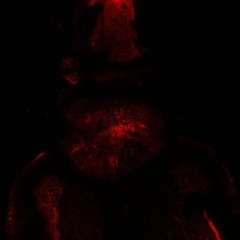 Orange-coiled-spring