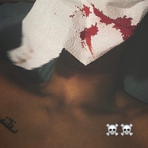 NOSEBLEED [prod. based1 + Z COOK]