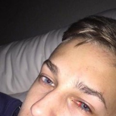 Balskinho- S K O N I S