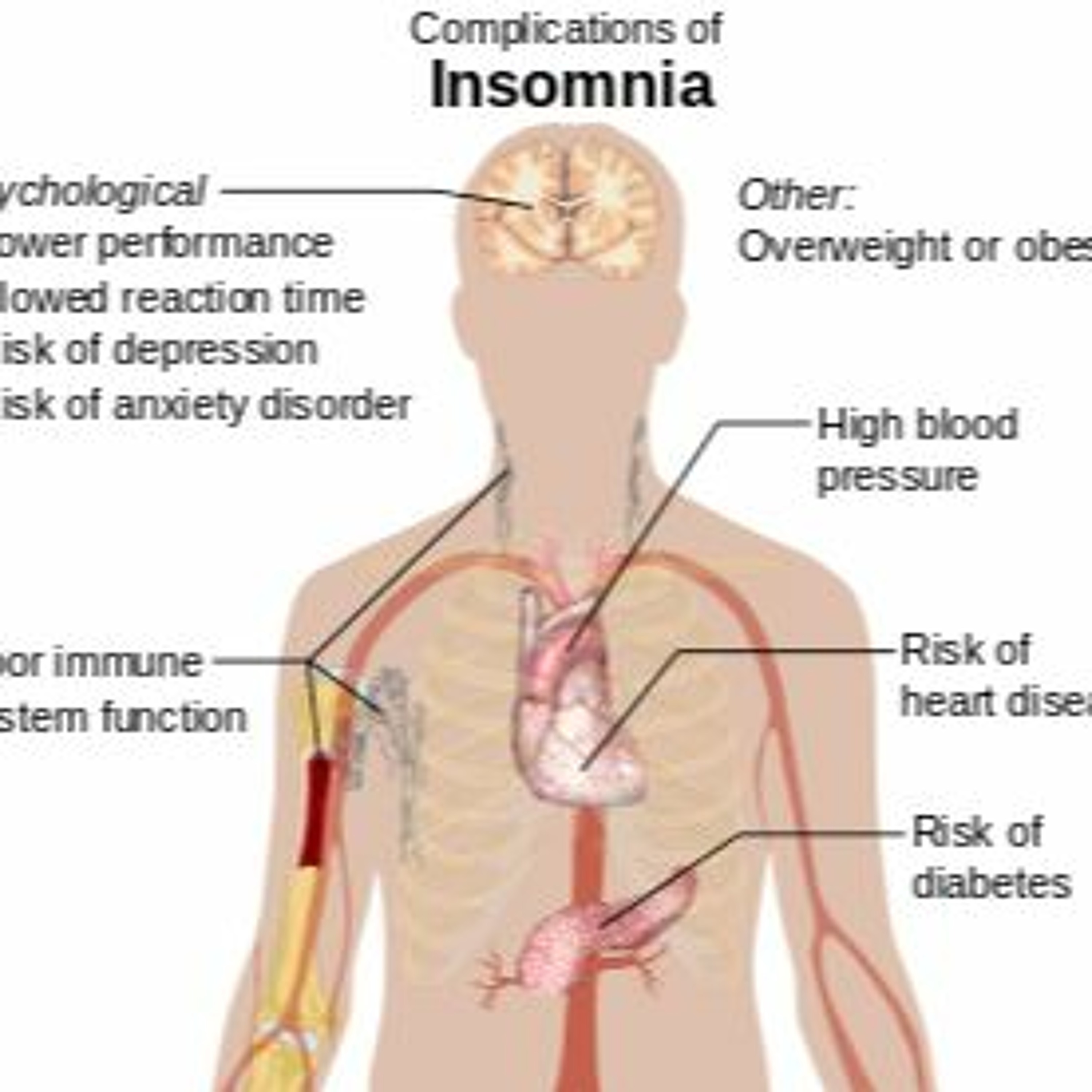 Insomnia - EHB™ episode artwork