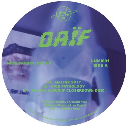 A1 - Malinx 2K17 (Snippet)