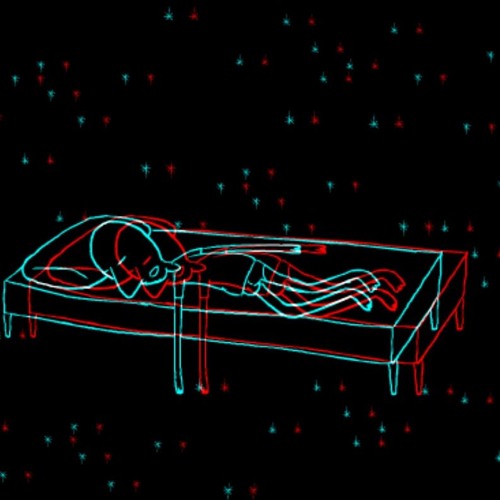 Anesthesia