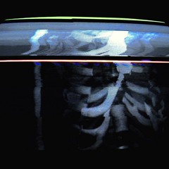 Carcass
