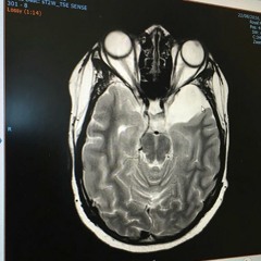 Omg He On X Games Mode