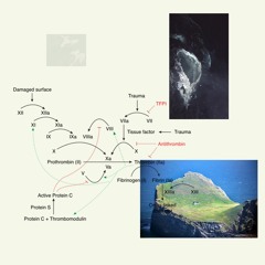 Undo x Coercer (Avbvrn Bootleg)