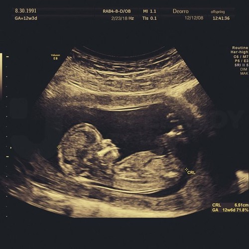 Deorro - Offspring (Extended Mix)