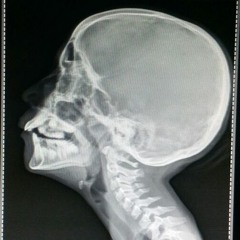 Where Do I Buy A Neck Brace