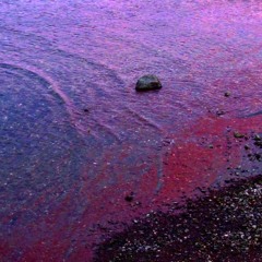 I'm Lactose Intolerant