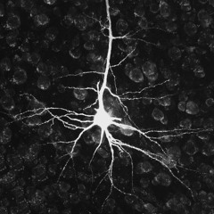 Neural Amplification [Introduction]