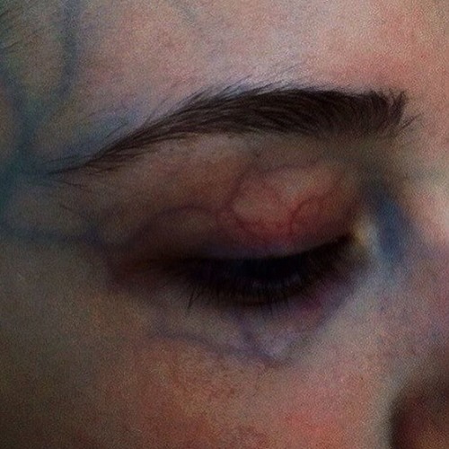 INSOMNIA