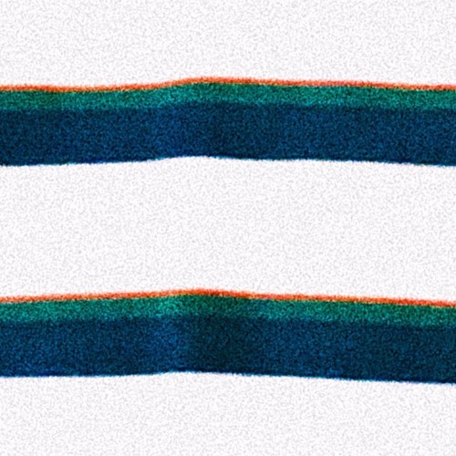 threads