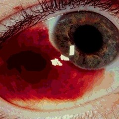 VSPINU x PSYCHONAUT - BLOODBATH