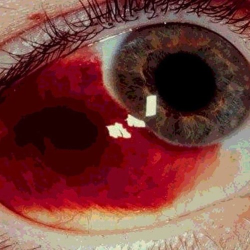 VSPINU x PSYCHONAUT - BLOODBATH