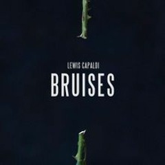 Lewis Capaldi - Bruises (Felix Wehden Bootleg)