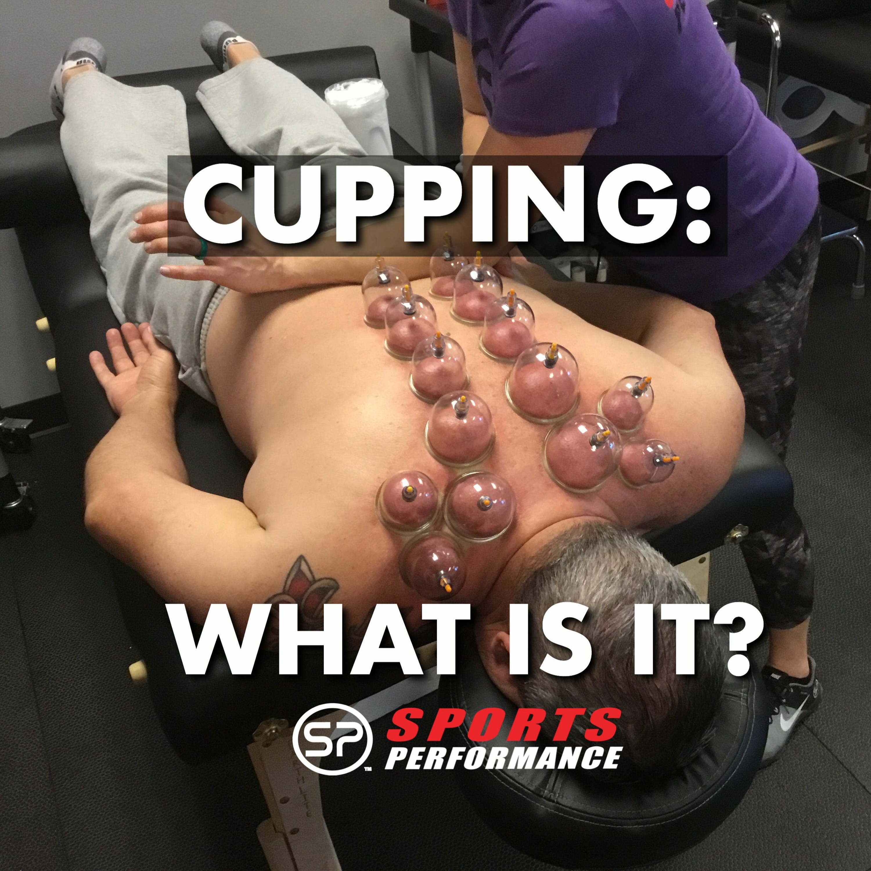 EP004 What is Cupping? episode artwork