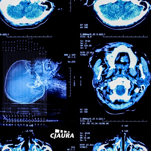 CJAW011 - Hedchef (Clips)