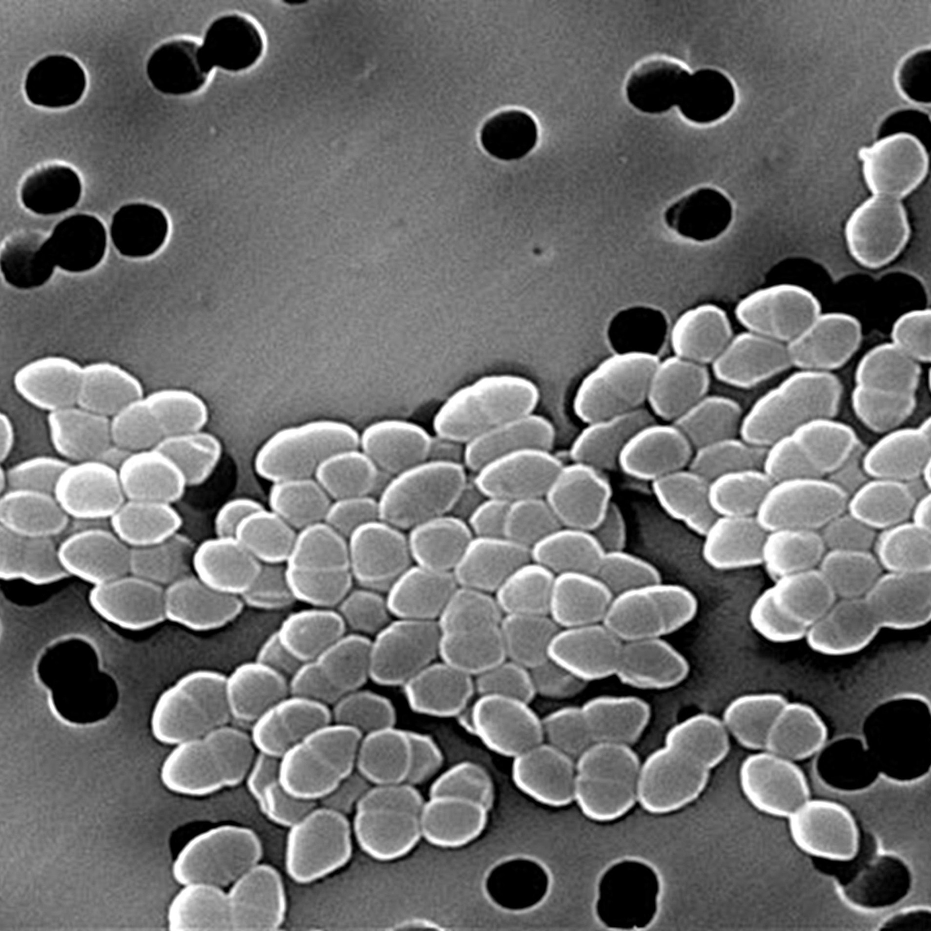 Re-thinking the theory of autoimmunity in the era of the microbiome