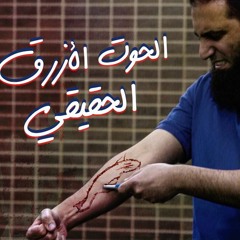 علاء حامد