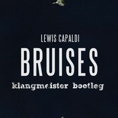 Lewis Capaldi - Bruises (klangmeister Bootleg)