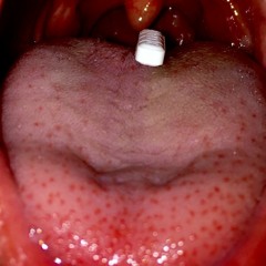 XANGEL (p.cybersuicide)