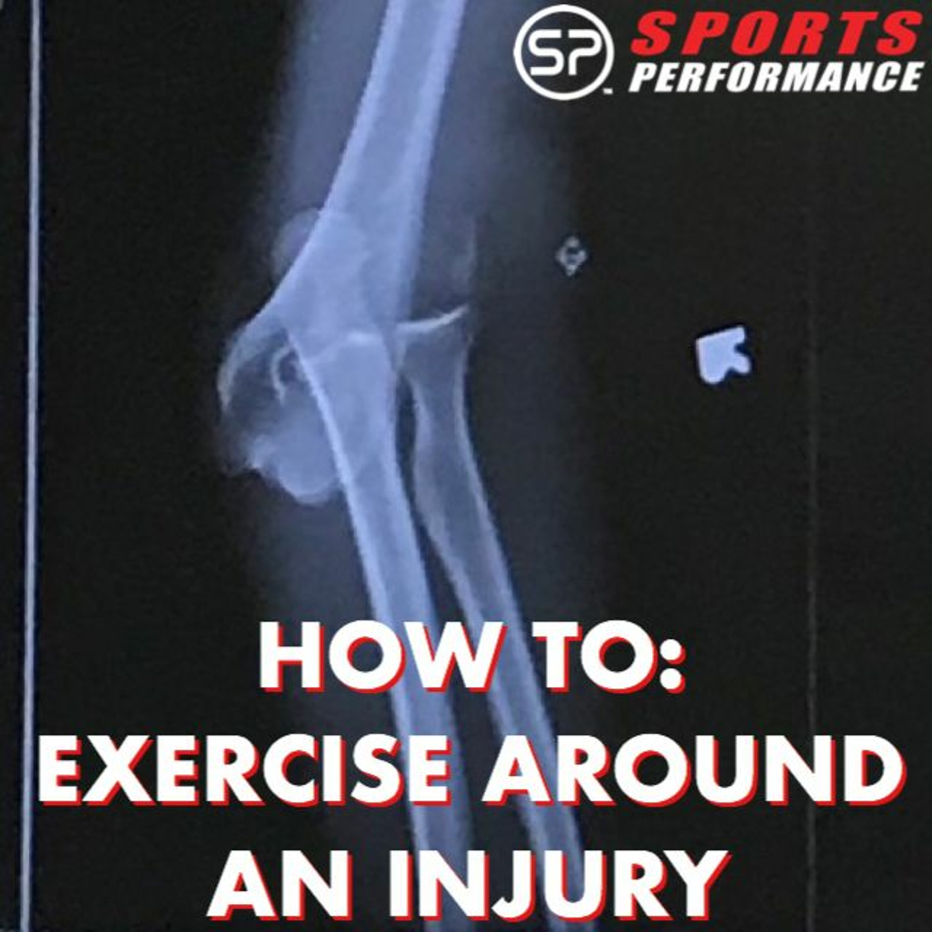 EP010 How To Exercise Around An Injury episode artwork