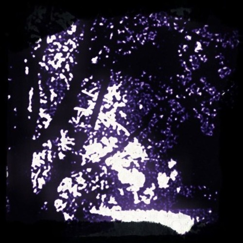 toxin x david entendu ~ in her nightmares (prod. born hero)