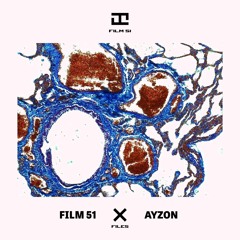 Ayzon - El Cholito