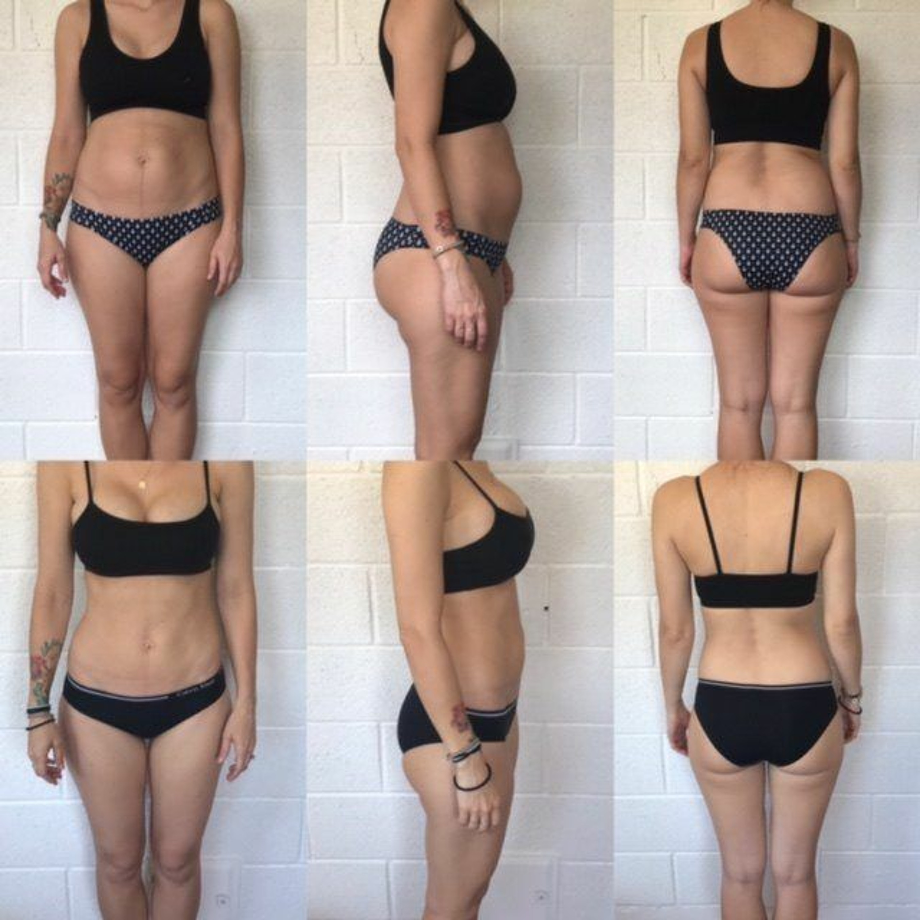 Postpartum Weight Loss Case Study + Treatment Tips