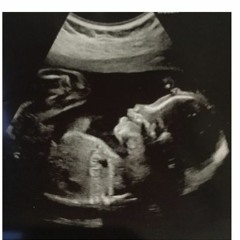 JDefianT - My Creation (Prod. By Westy)