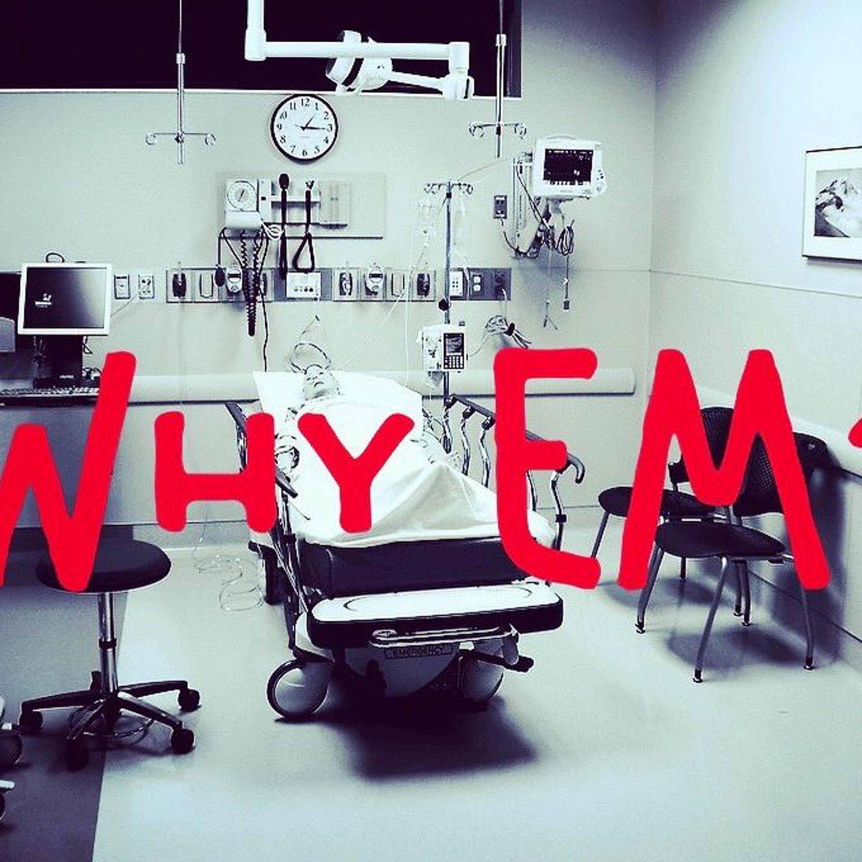 EM Over Easy