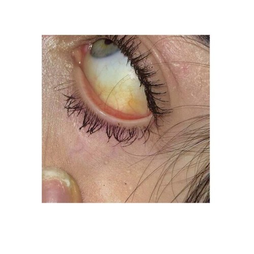 FLEXXY x KUQE - PLAN808 (prod. SUPREMÉ)