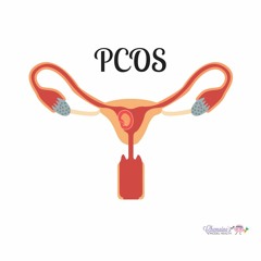 #082 PCOS or poly cystic ovarian syndrome